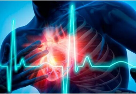 Какая разница между инсультом и инфарктом
